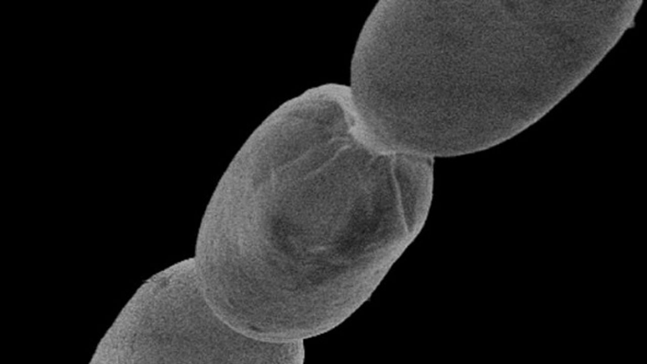 Dünyanın en büyük bakterisi bulundu