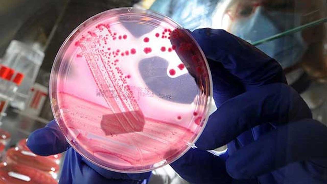 Mikropların var olduğuna inanmayan insanlar