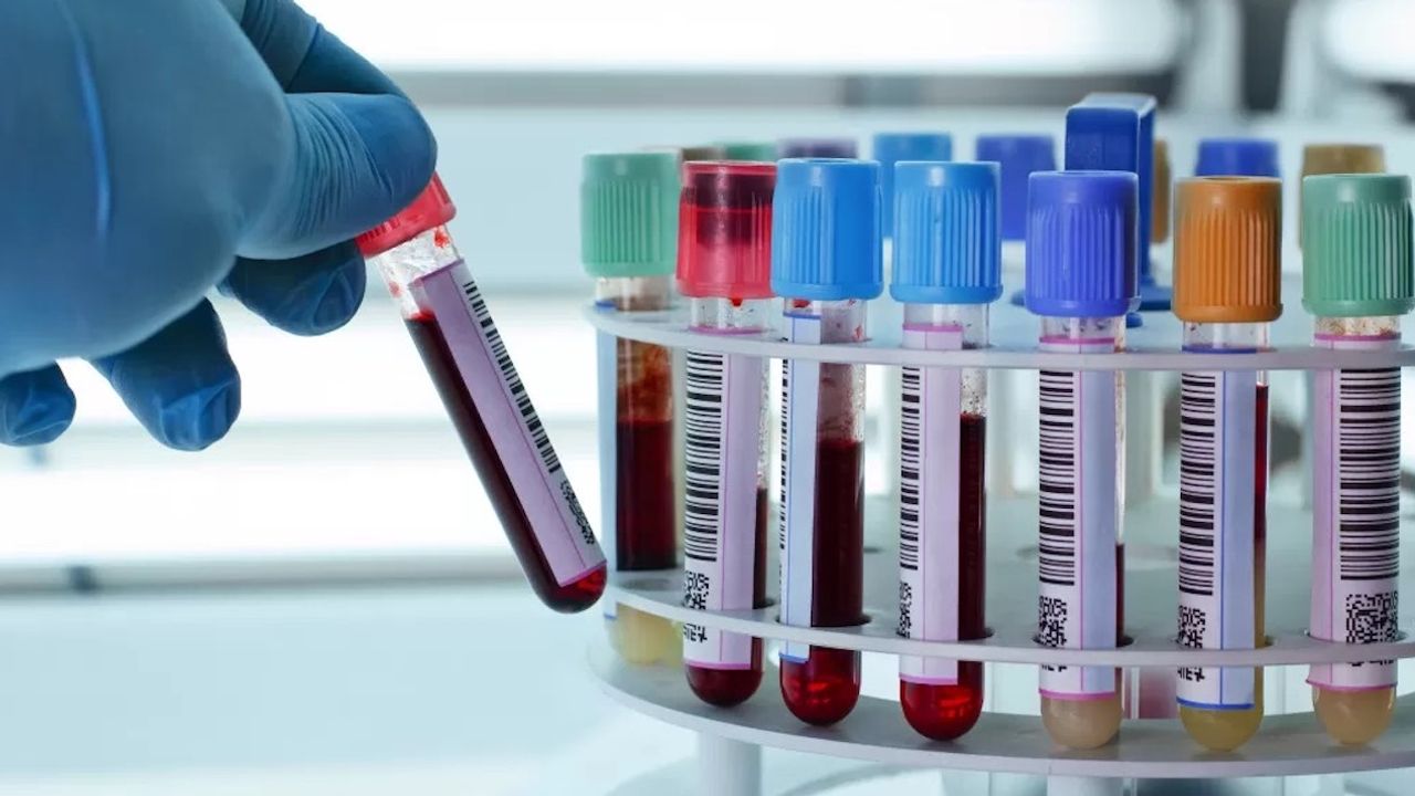 Organların hangi hızda yaşlandığını tespit edebilen yeni kan testi