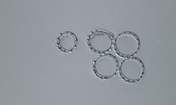 Erzincan'daki Göyne Barajı soğuk havanın etkisiyle dondu