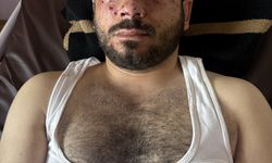 Suriye'de mayın temizleme sırasındaki patlamada AA muhabiri dahil 3 kişi yaralandı