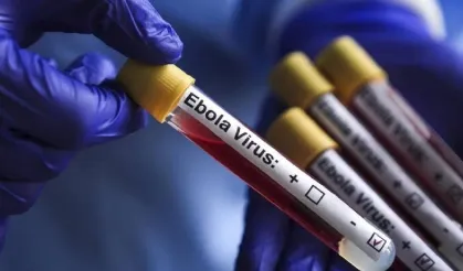 KKTC'den Ebola virüsüne karşı yeni tedbirler