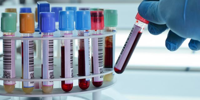 İngiltere'de yapılan kan testi, her üç kanserden ikisini tespit edebildi