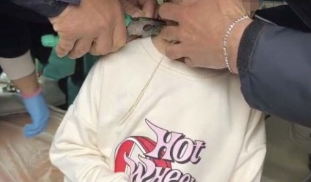 Adıyaman'da boynunu plastik kelepçeyle sıkan çocuğu itfaiye kurtardı