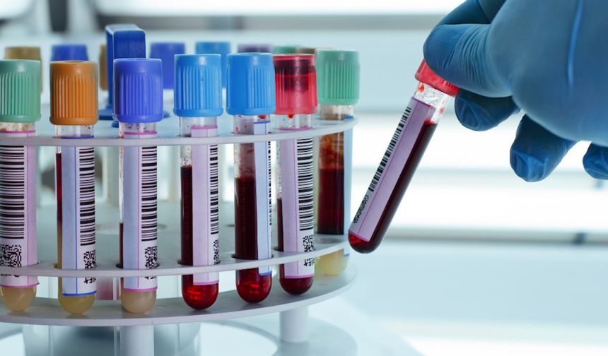 İngiltere'de yapılan kan testi, her üç kanserden ikisini tespit edebildi