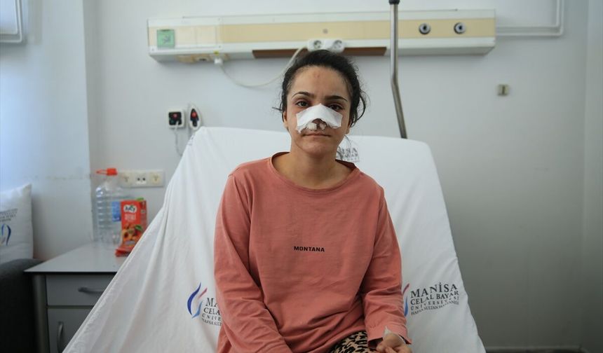 Manisa'da eşi tarafından burnunun bir kısmı ısırılarak koparılan kadın yaşadıklarını anlattı