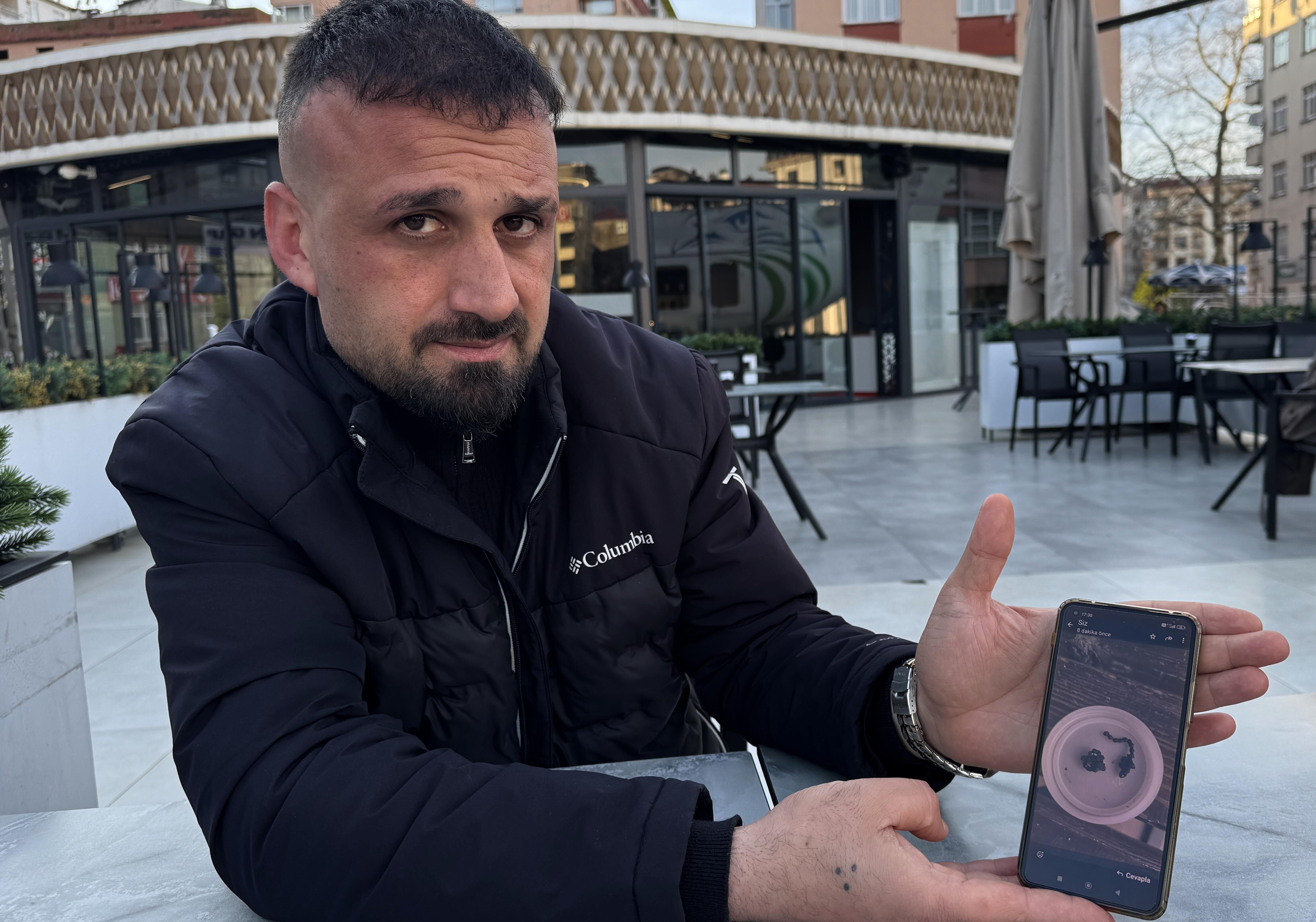 Rize'de burnundan zincir parçası çıkarılan çocuk sağlığına kavuştu